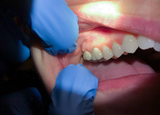 Best Cosmetic Emergency Dentistry in Scarsdale, NY