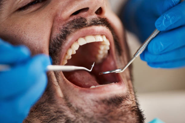 Best Emergency Gum Treatment in Scarsdale, NY